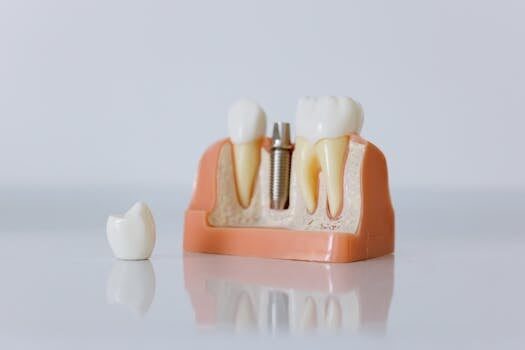 Gingivectomía: qué es y en qué casos se realiza